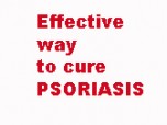 Treatment of psoriasis Screenshot