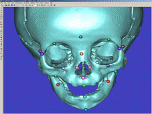 Mimics Medical Image Processing Screenshot